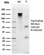 SP100 Antibody in SDS-PAGE (SDS-PAGE)