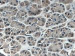 AGO2 Antibody in Immunohistochemistry (Paraffin) (IHC (P))