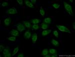 HIF1a Antibody in Immunocytochemistry (ICC/IF)