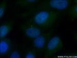 ARL13B Antibody in Immunocytochemistry (ICC/IF)