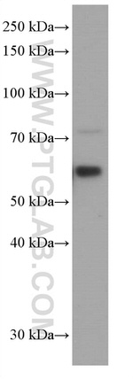 ARL13B Antibody in Western Blot (WB)