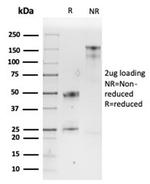 SPARC/Osteonectin Antibody in SDS-PAGE (SDS-PAGE)