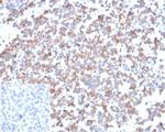 SPARC/Osteonectin Antibody in Immunohistochemistry (Paraffin) (IHC (P))