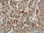 LACTB Antibody in Immunohistochemistry (Paraffin) (IHC (P))