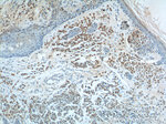 SOX10 Antibody in Immunohistochemistry (Paraffin) (IHC (P))