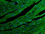 SOCS3 Antibody in Immunohistochemistry (Paraffin) (IHC (P))