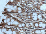 HPGD Antibody in Immunohistochemistry (Paraffin) (IHC (P))