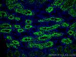 AQP1 Antibody in Immunohistochemistry (PFA fixed) (IHC (PFA))