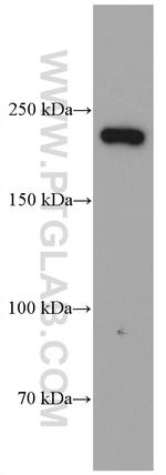 MYH14 Antibody in Western Blot (WB)