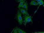 CPLX2 Antibody in Immunocytochemistry (ICC/IF)