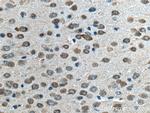 CPLX2 Antibody in Immunohistochemistry (Paraffin) (IHC (P))