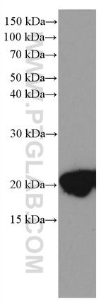 CPLX2 Antibody in Western Blot (WB)