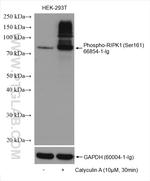 Phospho-RIPK1 (Ser161) Antibody in Western Blot (WB)
