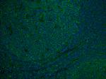 CD81 Antibody in Immunohistochemistry (Paraffin) (IHC (P))