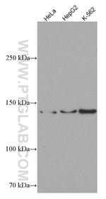 ROR1 Antibody in Western Blot (WB)