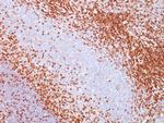 CD43 (T-Cell Marker) Antibody in Immunohistochemistry (Paraffin) (IHC (P))