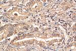 PPARG Antibody in Immunohistochemistry (Paraffin) (IHC (P))