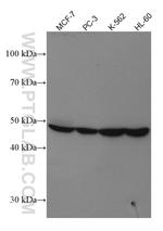 PPARG Antibody in Western Blot (WB)