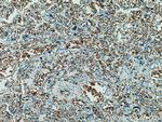 band 3/AE1 Antibody in Immunohistochemistry (Paraffin) (IHC (P))