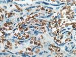 band 3/AE1 Antibody in Immunohistochemistry (Paraffin) (IHC (P))