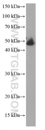 HAI-1 Antibody in Western Blot (WB)