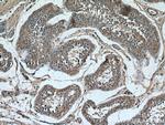 PLCD1 Antibody in Immunohistochemistry (Paraffin) (IHC (P))