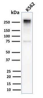 Spectrin Alpha 1 Antibody in Western Blot (WB)