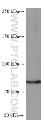 PKC Delta Antibody in Western Blot (WB)
