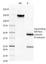 Spectrin beta III (SPTBN2) Antibody in SDS-PAGE (SDS-PAGE)