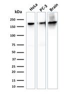 Spectrin beta III (SPTBN2) Antibody in Western Blot (WB)