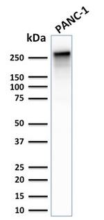 Spectrin beta III (SPTBN2) Antibody in Western Blot (WB)