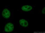 TCF3 Antibody in Immunocytochemistry (ICC/IF)