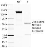 BRCA1 (Breast Marker) Antibody in SDS-PAGE (SDS-PAGE)