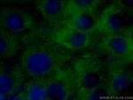 STMN2 Antibody in Immunocytochemistry (ICC/IF)