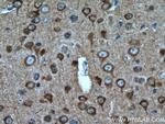 STMN2 Antibody in Immunohistochemistry (Paraffin) (IHC (P))