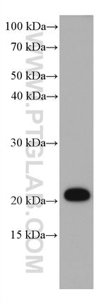 STMN2 Antibody in Western Blot (WB)