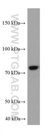 COIL Antibody in Western Blot (WB)