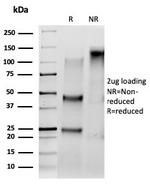 Serum Response Element Binding Transcription Factor (SRF) Antibody in SDS-PAGE (SDS-PAGE)