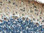 MYH10 Antibody in Immunohistochemistry (Paraffin) (IHC (P))