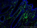 Collagen Type I Antibody in Immunohistochemistry (Paraffin) (IHC (P))