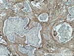 Collagen Type I Antibody in Immunohistochemistry (Paraffin) (IHC (P))