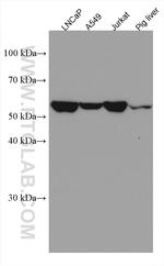 EPHX2 Antibody in Western Blot (WB)