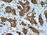 PTPN2 Antibody in Immunohistochemistry (Paraffin) (IHC (P))