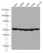 PTPN2 Antibody in Western Blot (WB)