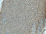 LACTB2 Antibody in Immunohistochemistry (Paraffin) (IHC (P))