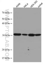 LACTB2 Antibody in Western Blot (WB)