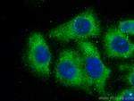 CCT5 Antibody in Immunocytochemistry (ICC/IF)