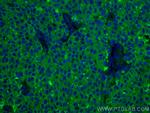 ERO1L Antibody in Immunohistochemistry (Paraffin) (IHC (P))