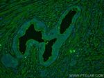 TAOK3 Antibody in Immunohistochemistry (Paraffin) (IHC (P))