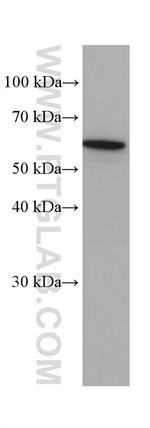 SLC22A7 Antibody in Western Blot (WB)